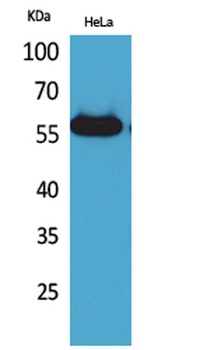 Amylase rabbit pAb Antibody