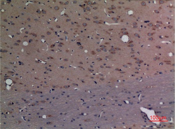 CPE rabbit pAb Antibody