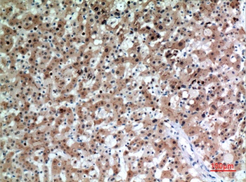 CD66e rabbit pAb Antibody