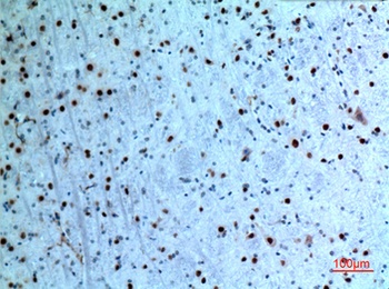 Cytokeratin 14 rabbit pAb Antibody