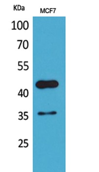 Angptl4 rabbit pAb Antibody
