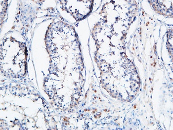 Angptl4 rabbit pAb Antibody
