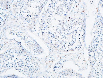 Angptl4 rabbit pAb Antibody