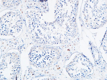 Angptl4 rabbit pAb Antibody