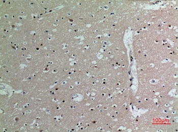 IL-16 rabbit pAb Antibody