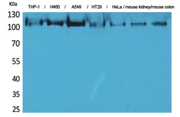 cPLA2 rabbit pAb Antibody