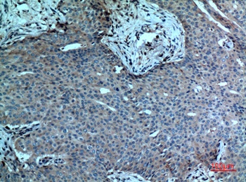 cPLA2 rabbit pAb Antibody