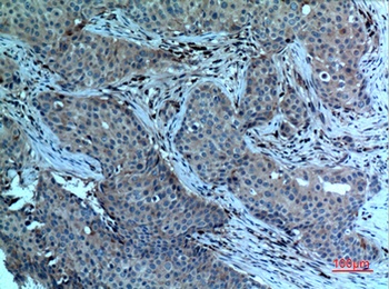 cPLA2 rabbit pAb Antibody