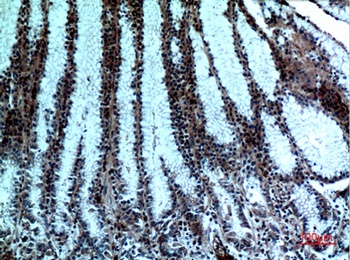cPLA2 rabbit pAb Antibody