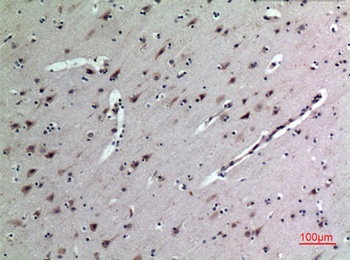 MK rabbit pAb Antibody