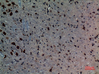 ALK-1 rabbit pAb Antibody