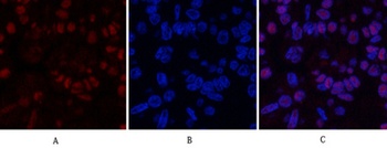 MDM2 rabbit pAb Antibody