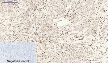MDM2 rabbit pAb Antibody