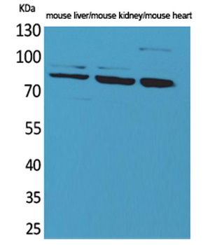 CUL-4B rabbit pAb Antibody