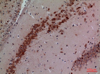 CUL-4B rabbit pAb Antibody