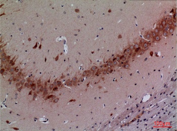 CUL-4B rabbit pAb Antibody