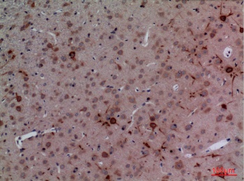 CUL-4B rabbit pAb Antibody