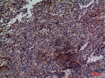 Cdc34 rabbit pAb Antibody