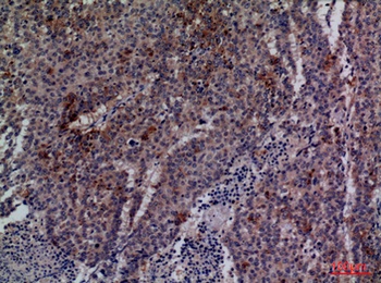 Cdc34 rabbit pAb Antibody
