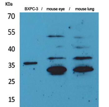 TF rabbit pAb Antibody