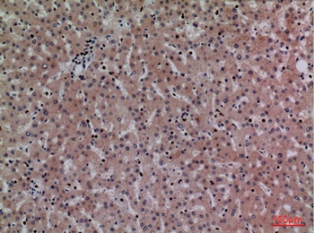 CRP rabbit pAb Antibody