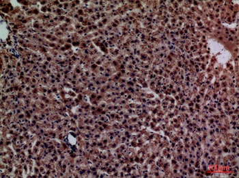 CRP rabbit pAb Antibody