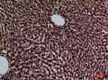 CRP rabbit pAb Antibody