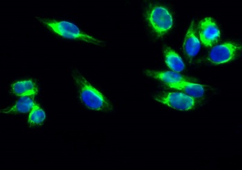 Cdk4 rabbit pAb Antibody