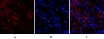 Cdk4 rabbit pAb Antibody