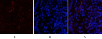 Cdk4 rabbit pAb Antibody