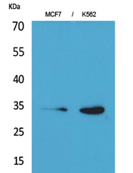 Cdk4 rabbit pAb Antibody