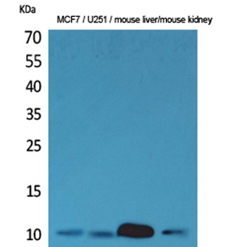 ACBP rabbit pAb Antibody