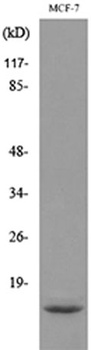 ACBP rabbit pAb Antibody