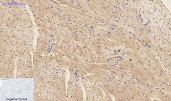IL-1β rabbit pAb Antibody