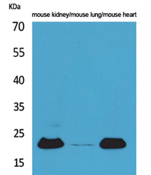 ADM rabbit pAb Antibody