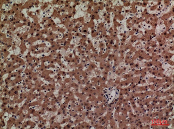 ADM rabbit pAb Antibody