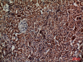 ADM rabbit pAb Antibody