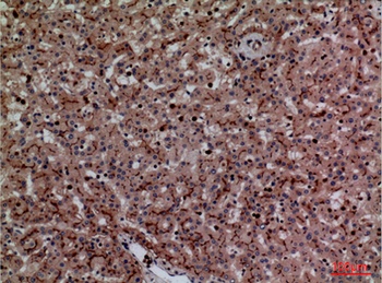 CEACAM1/5 rabbit pAb Antibody