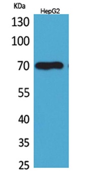 Glypican-3 rabbit pAb Antibody