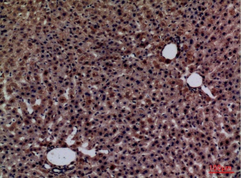 Glypican-3 rabbit pAb Antibody