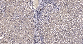 MIP-1β rabbit pAb Antibody