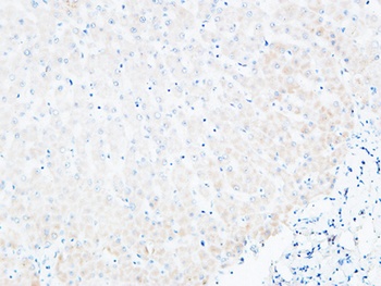 BLC rabbit pAb Antibody