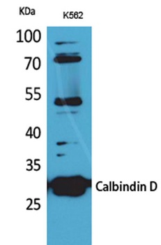 Calbindin D28K rabbit pAb Antibody