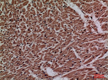 P2X3 rabbit pAb Antibody