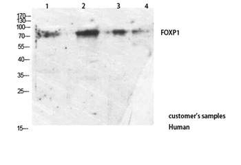 FOXP1 rabbit pAb Antibody