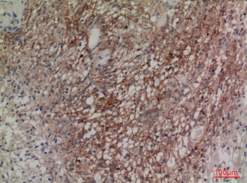 Neuregulin-2 rabbit pAb Antibody