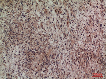 Lipocalin-1 rabbit pAb Antibody