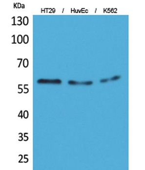 CYP11B1/2 rabbit pAb Antibody