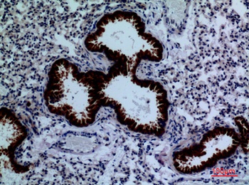 DPYD rabbit pAb Antibody