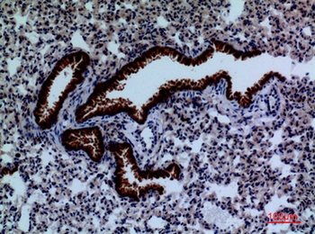 DPYD rabbit pAb Antibody